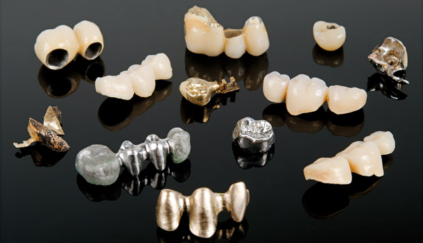 牙冠材質這麼多種，怎麼選？