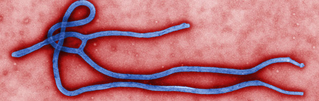關於伊波拉病毒　你必須知道的８個關鍵