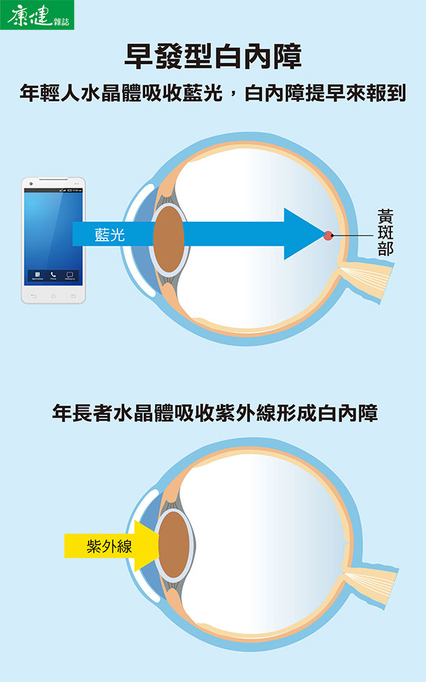 黄斑部或视网膜病变患者以及3c产品的重度使用者,应配戴防蓝光眼镜.